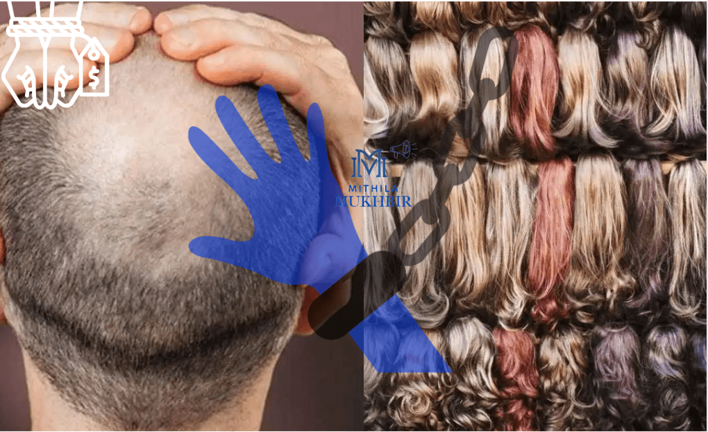 Madhubani बॉर्डर पर इंसानी बाल तस्करी की बड़ी खेप बरामद,क़ीमत हैं 80 लाख 14 Madhubani बॉर्डर पर इंसानी बाल की तस्करी का अब तक का सबसे गंभीर मामला सामने आया है।